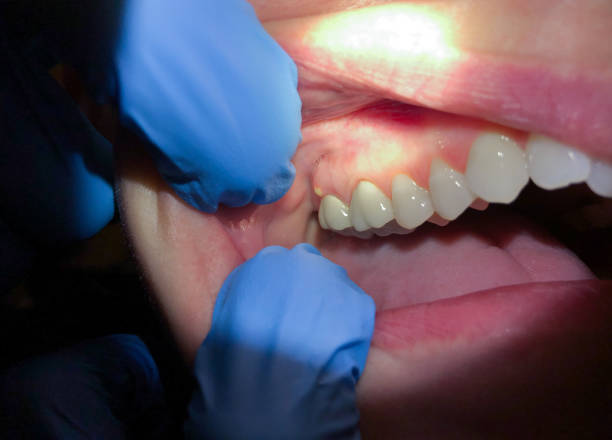 Best Walk-In Emergency Dentist in Paddock Lake, WI